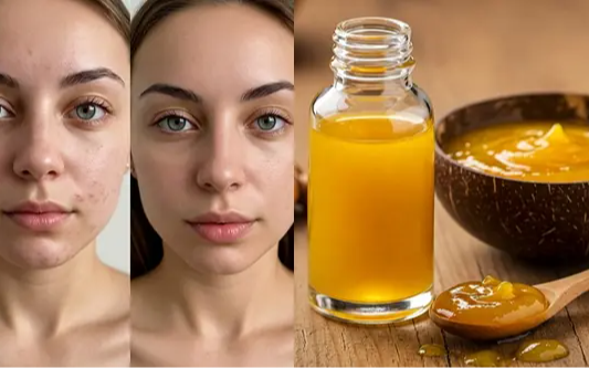Say Goodbye to Dark Spots with These Easy DIY Turmeric Skincare Recipes