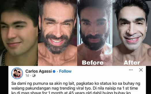 “I Am More Than a Face”: Carlos Agassi Breaks Silence on Body Shaming After Viral Beard Photo